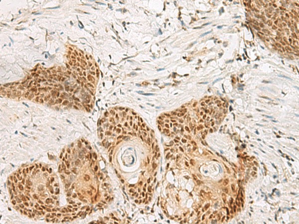 PSPC1 Polyclonal Antibody (E-AB-18827)