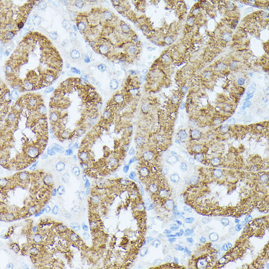 PLS1 Polyclonal Antibody (E-AB-65257)