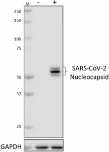 Purified anti-SARS-CoV-2 Nucleocapsid Antibody (940901)
