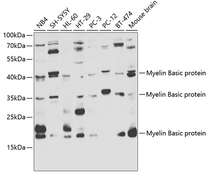 Myelin Basic protein Polyclonal Antibody (E-AB-60400)