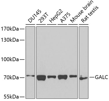 GALC Polyclonal Antibody (E-AB-62750)