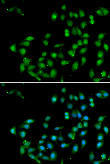 CTNNBL1 Polyclonal Antibody (E-AB-61222)