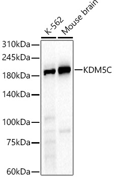 KDM5C Polyclonal Antibody (E-AB-91265)