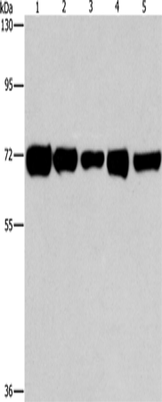 RPN1 Polyclonal Antibody (E-AB-14657)