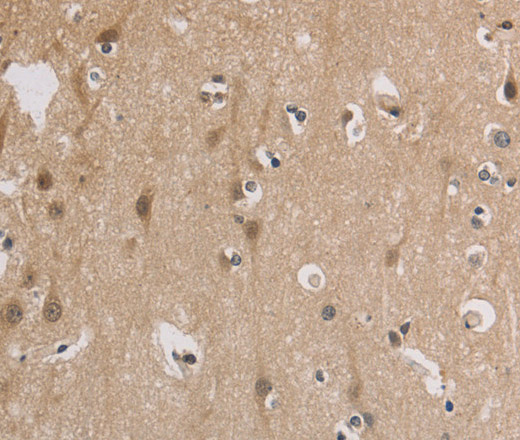 ELOVL1 Polyclonal Antibody (E-AB-11189)