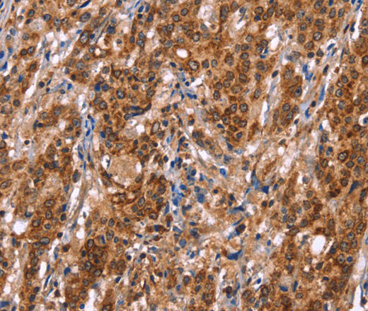 TDP2 Polyclonal Antibody (E-AB-13226)