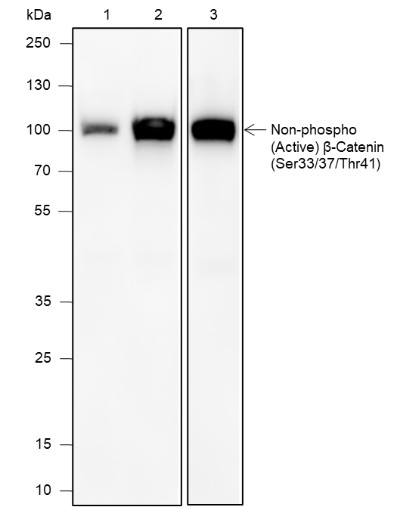 Recombinant Non-Phospho (Active) β-Catenin (Ser33, Ser37, Thr41) Monoclonal Antibody (AN301881L)