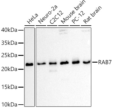 RAB7A Polyclonal Antibody (E-AB-68291)