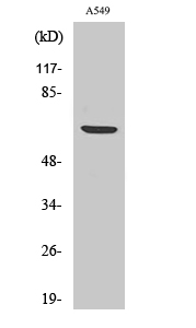Phospho-p70 S6 kinase alpha (Ser447) Polyclonal Antibody (E-AB-20959)