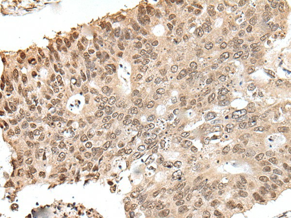 ZNF410 Polyclonal Antibody (E-AB-52387)