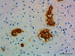 Purified anti-β-Amyloid, 1-15 Antibody (847501)