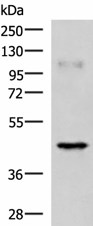 RAB3IL1 Polyclonal Antibody (E-AB-52926)