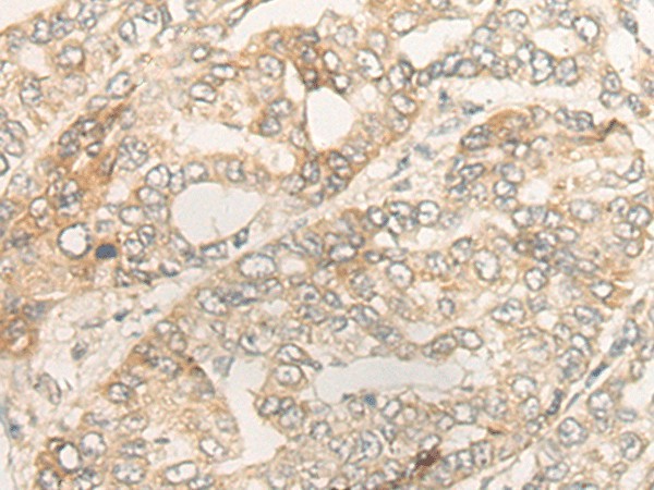 DUOX2 Polyclonal Antibody (E-AB-17895)