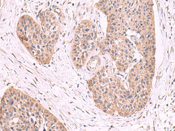 MGP Polyclonal Antibody (E-AB-52676)