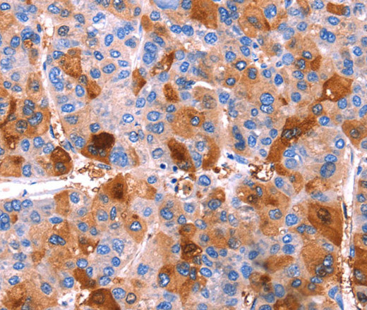 ERN2 Polyclonal Antibody (E-AB-13221)