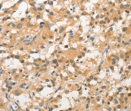STAM Polyclonal Antibody (E-AB-10881)