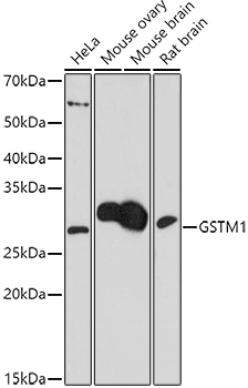 GSTM1 Polyclonal Antibody (E-AB-91795)