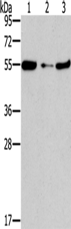 FGFR1OP Polyclonal Antibody (E-AB-15032)