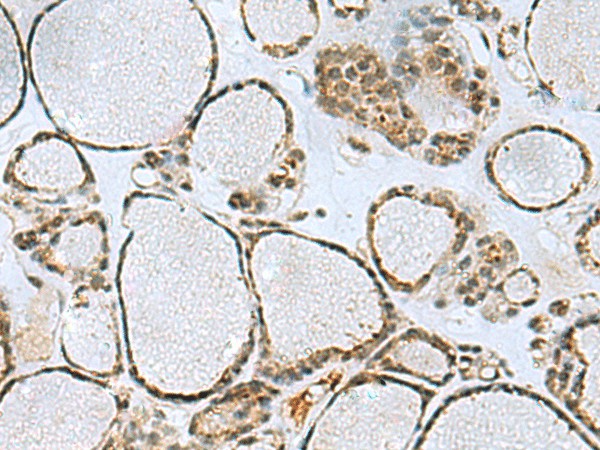 PTPA Polyclonal Antibody (E-AB-19232)