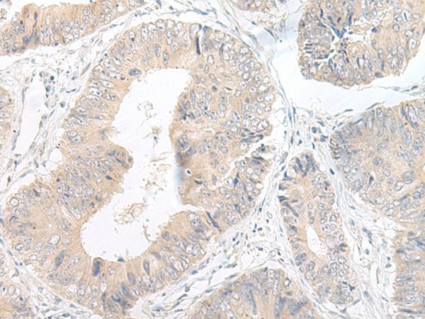LYRM2 Polyclonal Antibody (E-AB-18757)
