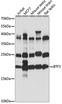BTF3 Polyclonal Antibody (E-AB-91086)