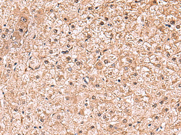 RUSC1 Polyclonal Antibody (E-AB-19038)