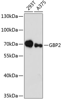 GBP2 Polyclonal Antibody (E-AB-64408)