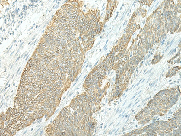ETAA1 Polyclonal Antibody (E-AB-17925)
