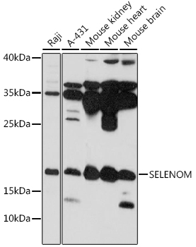 SELENOM Polyclonal Antibody (E-AB-91606)