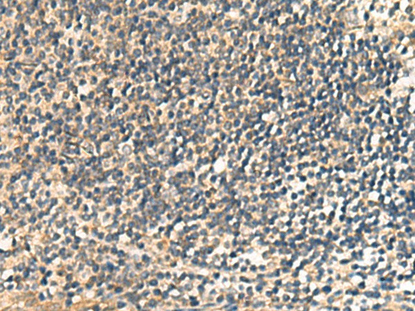 CNST Polyclonal Antibody (E-AB-53127)