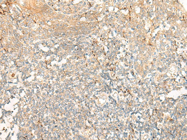 GCAT Polyclonal Antibody (E-AB-52743)