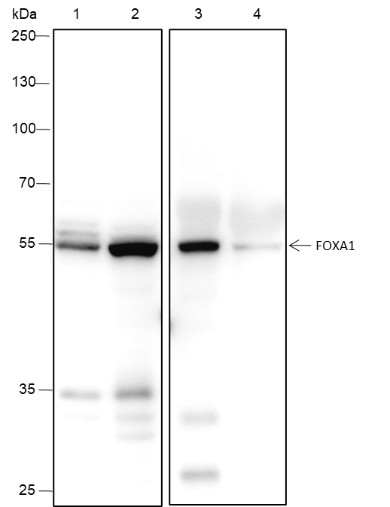 Recombinant FOXA1 Monoclonal Antibody (AN301524L)