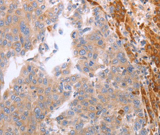 NRTN Polyclonal Antibody (E-AB-12824)