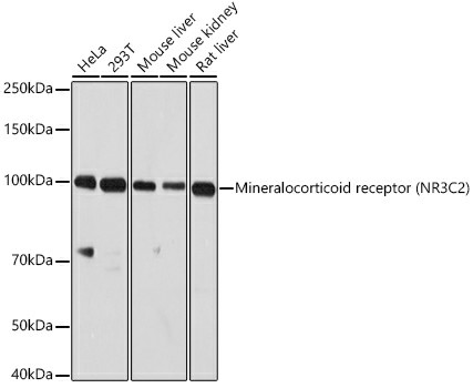 NR3C2 Polyclonal Antibody (E-AB-93380)