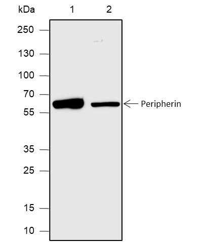 Recombinant Peripherin Monoclonal Antibody (AN301899L)