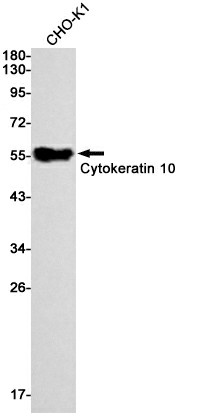 Recombinant Cytokeratin 10 Monoclonal Antibody (E-AB-81452)
