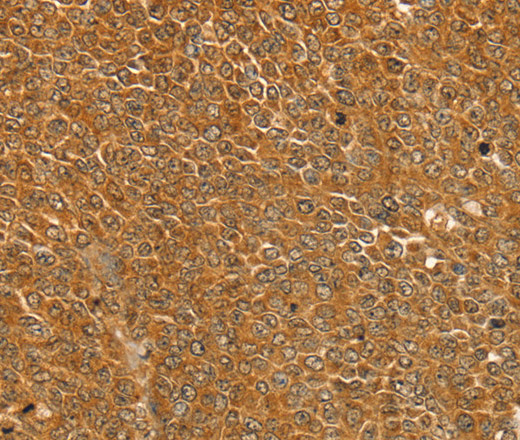 ST18 Polyclonal Antibody (E-AB-15416)