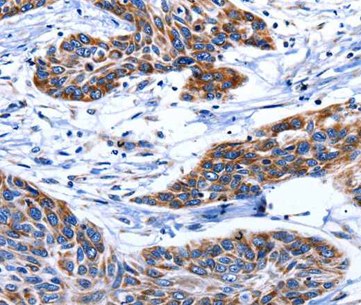 AQP8 Polyclonal Antibody (E-AB-12345)