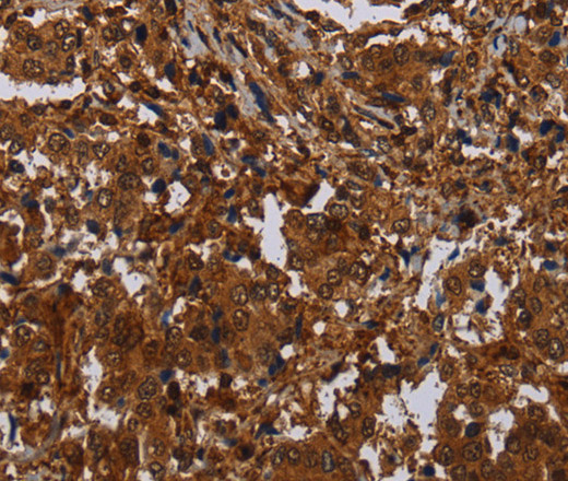 MAGEB18 Polyclonal Antibody (E-AB-16585)