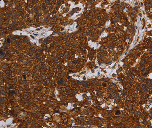 ERRFI1 Polyclonal Antibody (E-AB-13418)
