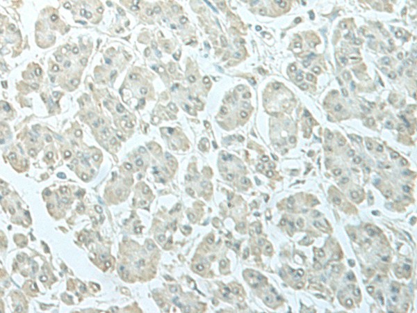 C8orf4 Polyclonal Antibody (E-AB-18766)