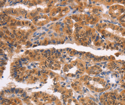 NCAPG2 Polyclonal Antibody (E-AB-16296)