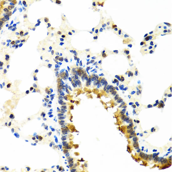 CRTAP Polyclonal Antibody (E-AB-63036)