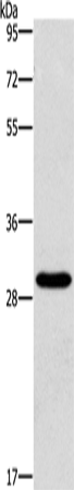 BCL10 Polyclonal Antibody (E-AB-10997)