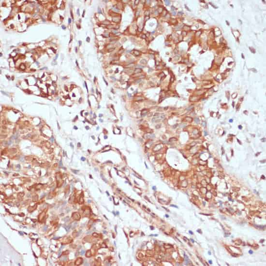 PTPRN2 Polyclonal Antibody (E-AB-65105)