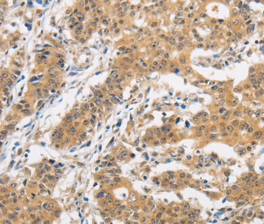 ITGB3BP Polyclonal Antibody (E-AB-10402)