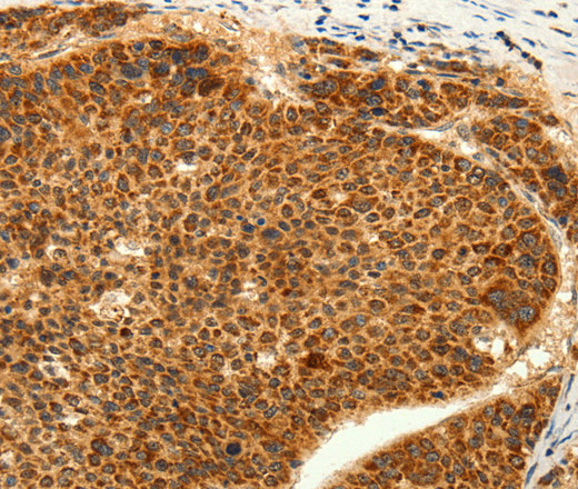 TRPC6 Polyclonal Antibody (E-AB-16106)