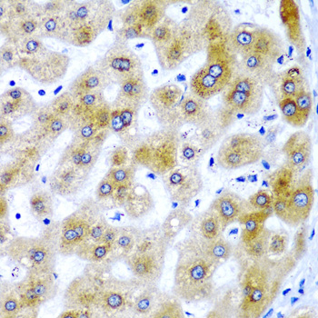 SECISBP2 Polyclonal Antibody (E-AB-61334)