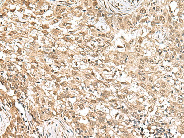 RPS6KA5 Polyclonal Antibody (E-AB-52987)