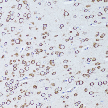 TNFRSF11A Polyclonal Antibody (E-AB-64599)